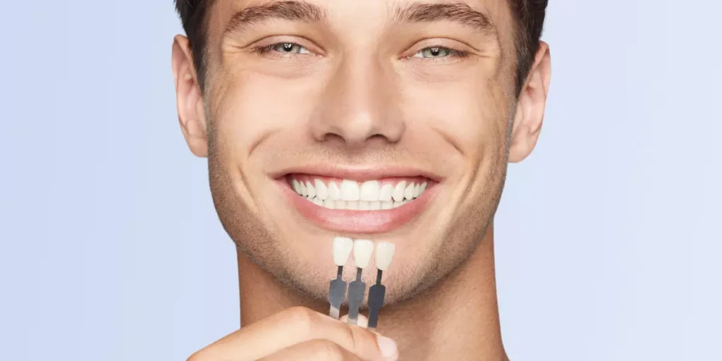 Hollywood Smile in Antalya