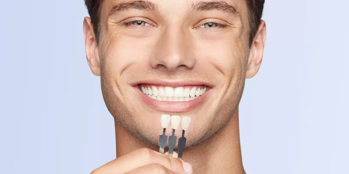 Hollywood Smile in Antalya