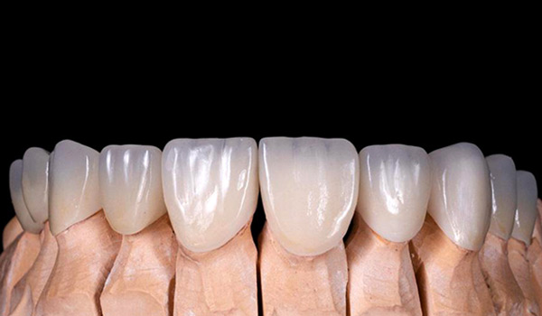 Zirconia Crown in Antalya